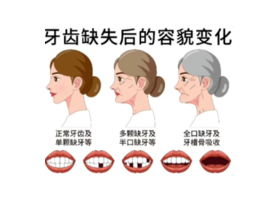 【科學(xué)科普】十個(gè)常用的口腔小知識(shí)！