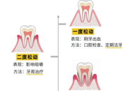 老年人牙齒松動了要怎么辦？