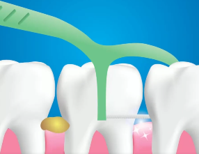 口腔問題可能要“命”！5大預(yù)警信號，別忽視